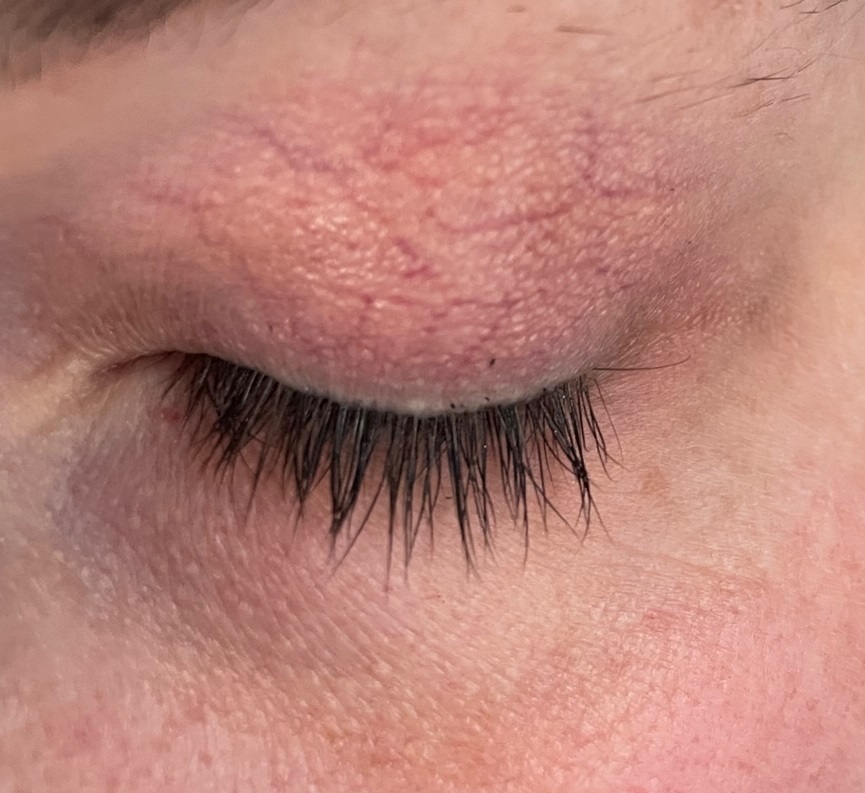 ORPHICA Realash Wimpernserum Ergebnis